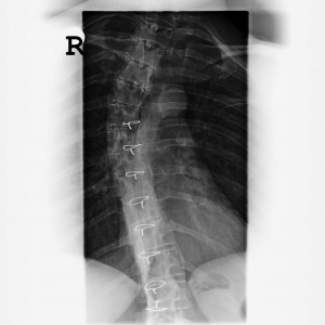x-ray-image-510488_1920